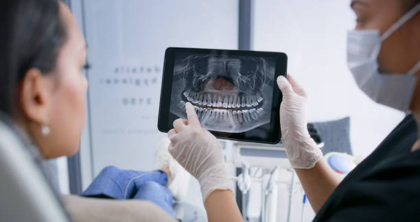 Licensed Tooth Extraction service in Huntsville, TX - Smile Center Dentistry